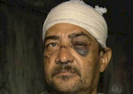 Homem é espancado pela mulher