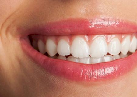 Cinco perguntas que explicam o tratamento com implantes dentários em apenas 72h