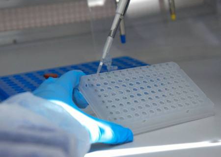 UFRJ desenvolve teste de baixo custo para detecção de covid-19