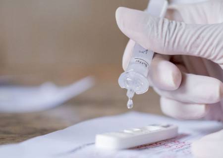 Covid-19: testes rápidos estão incluídos nos planos de saúde