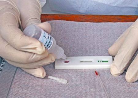 SES confirma 1,4 mil novos casos e 18 mortes por Covid-19 no Estado