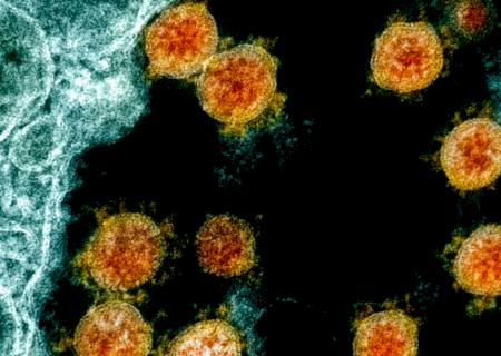 Fiocruz e Harvard explicam em estudo inflamação excessiva da covid-19