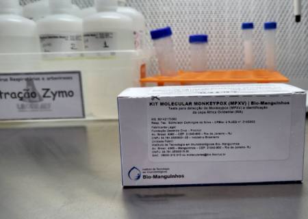 Ministério da Saúde envia kits para diagnóstico da Monkeypox em MS