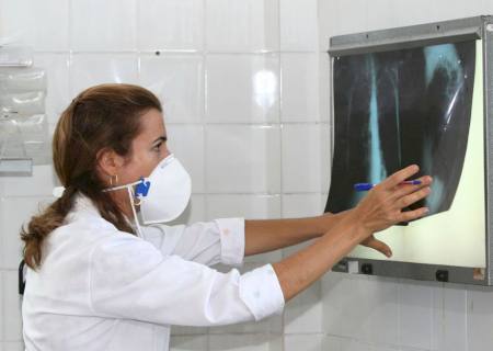 Brasil registra 78 mil novos casos de tuberculose