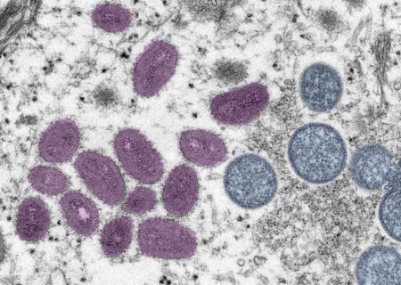 OMS alerta para variante mais perigosa de mpox