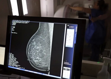 Cerca de 77 mil mulheres aguardam mamografia pelo SUS