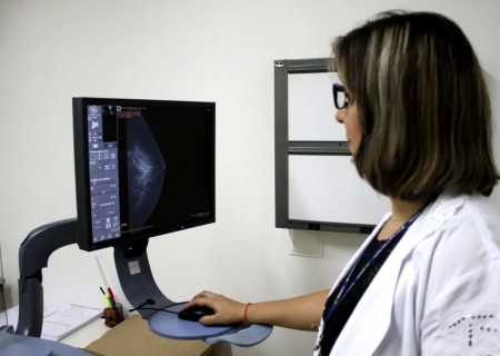 Entidades médicas pedem faixa etária maior para mamografia de rastreio
