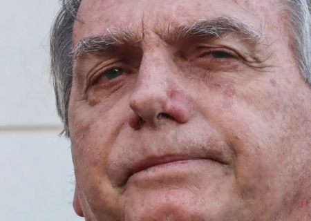 Bolsonaro apresenta piora clínica e vai passar por novos exames