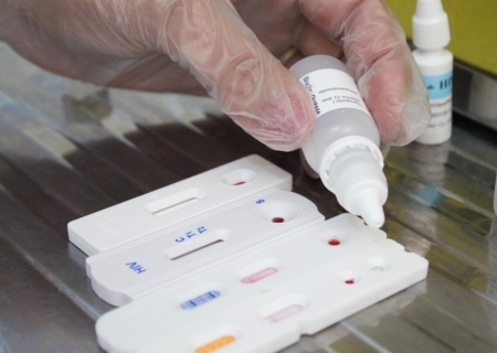 Saúde intensifica testagem e vacinação contra hepatites virais
