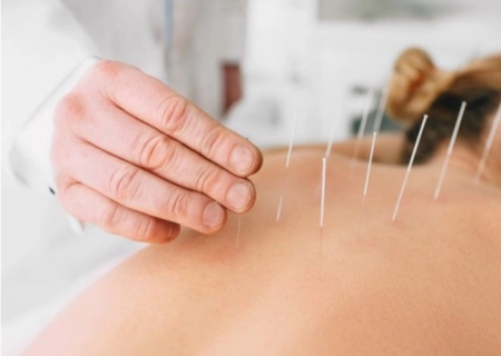 Saúde capacita médicos para consolidar acupuntura na rede pública em Mato Grosso do Sul