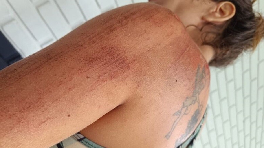 Motorista é preso após arrastar mulher e criança durante corrida por aplicativo