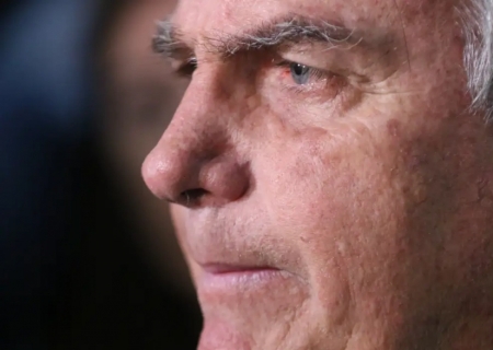 Com crise persistente de soluços, Bolsonaro faz nova cirurgia
