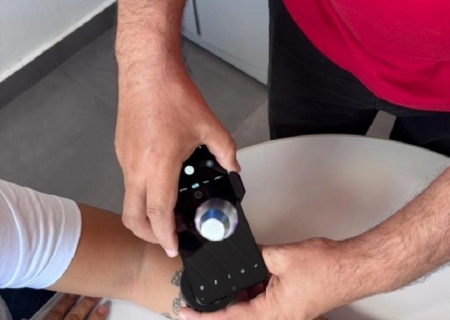 Teledermatologia fortalece diagnóstico precoce de câncer de pele em MS