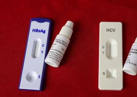 Dia Mundial de Luta contra as Hepatites Virais reforça importância da prevenção e do diagnóstico