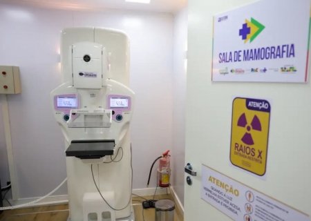 Cirurgias plásticas de mama no SUS crescem 54% em dez anos