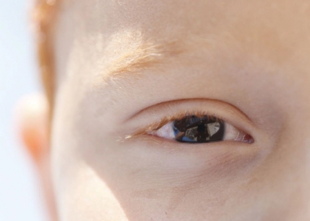 Baixa visão na infância pode afetar desenvolvimento e exige diagnóstico precoce
