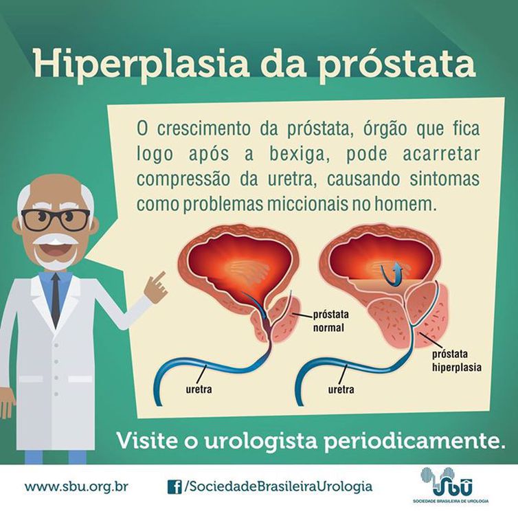 Divulgação/Sociedade Brasileira de Urologia